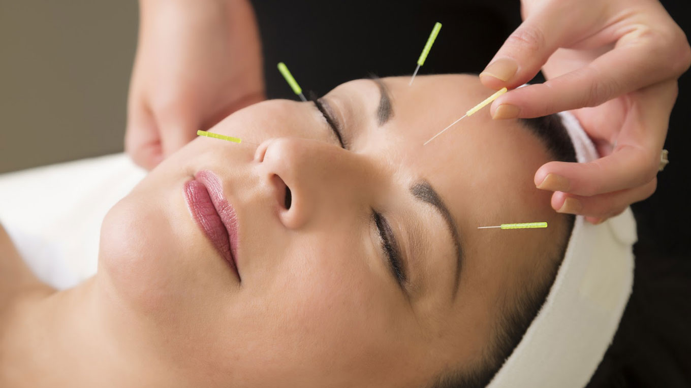 Woman getting an acupuncture facial